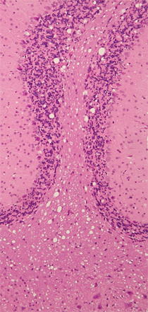 cerebellum.png
