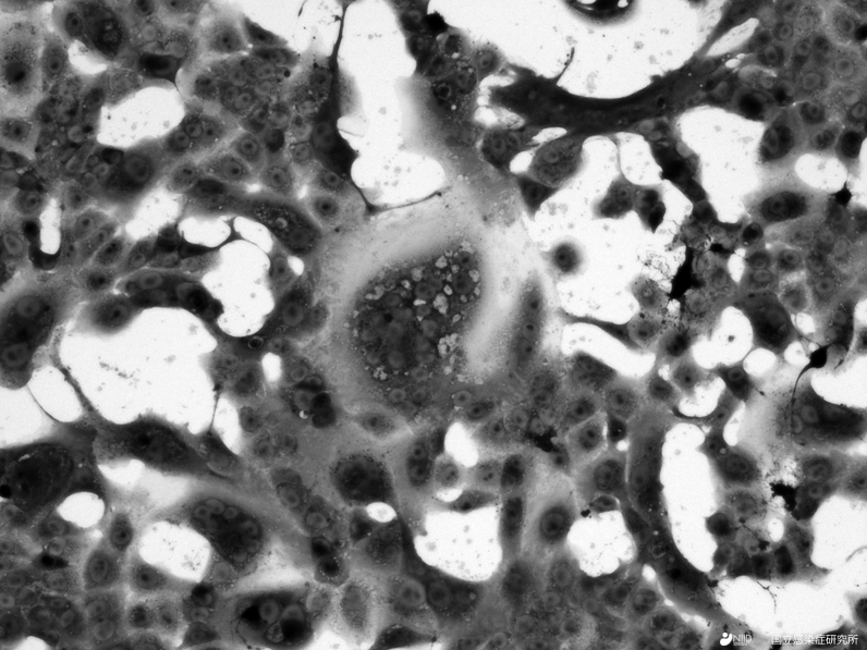 2019nCoV-200130cellculture_niid.jpg