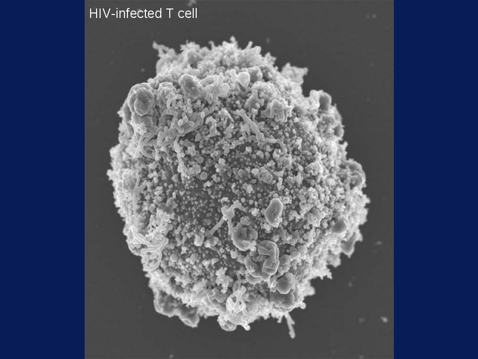 HIV-EM.png
